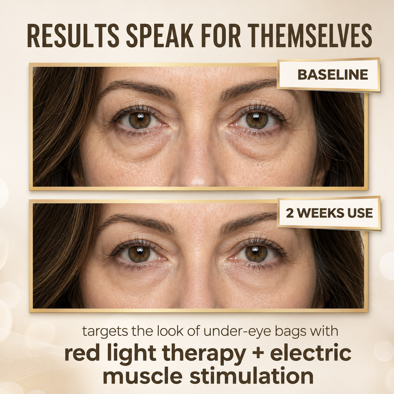 GlowVisor™ — Red Light + EMS Eye Therapy To Depuff & Glow