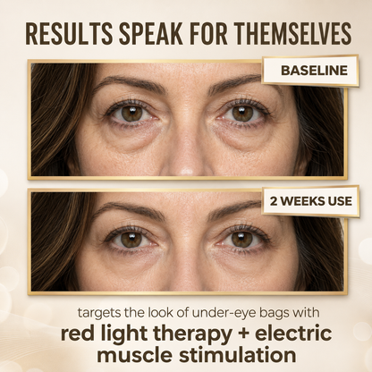 GlowVisor™ — Red Light + EMS Eye Therapy To Depuff & Glow